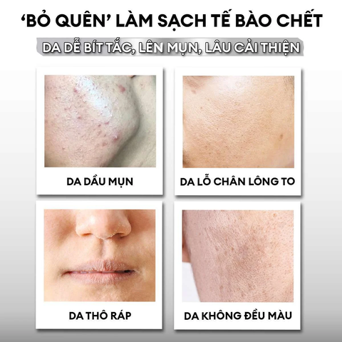 Tẩy tế bào chết kết hợp mặt nạ 2in1 Exfoliation Cream 40g