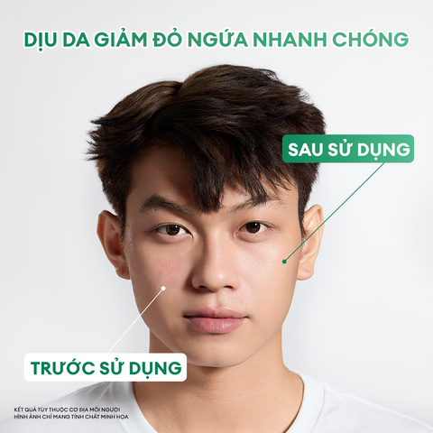 Kem dưỡng ẩm B5 & Bioactive Derma Pro giúp phục hồi da sau mụn, da khô, da nhạy cảm 50g