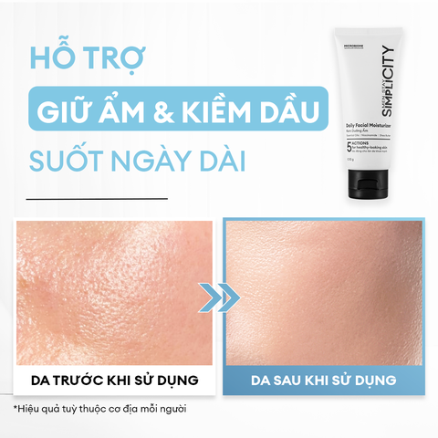 Kem dưỡng ẩm 5 trong 1 kiềm dầu giảm nhờn cho da thường đến da dầu 80g