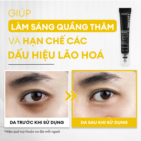 Kem mắt Recharge Pro dưỡng sáng, ngừa quầng thâm và nếp nhăn 15G