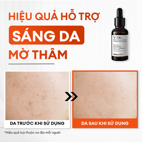 Serum Vital dưỡng trắng mờ thâm phức hợp Peptide + 5% Niacinamide 30ml
