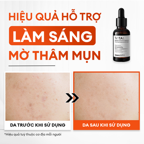 Combo mờ thâm sáng da tiêu chuẩn Brightening Trio