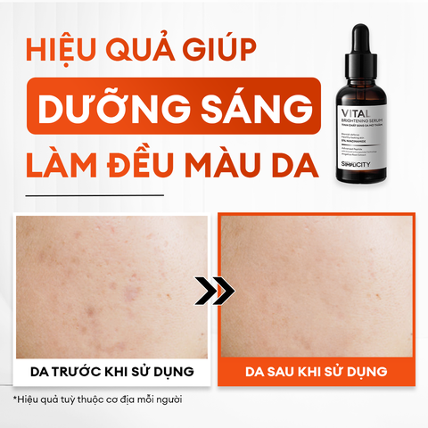 Combo Brightening Duo dưỡng trắng mờ thâm tiết kiệm: Sữa rửa mặt 100g & Serum Vital 30ml