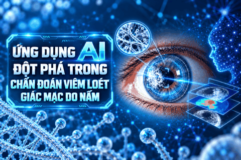 Đột phá mới trong chẩn đoán viêm loét giác mạc do nấm nhờ mô hình AI lai CSwinFK