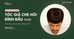 Tóc Giả Che Hói Đỉnh Đầu Nam: Chọn Sao Cho Tự Nhiên, Không Bị Lộ?