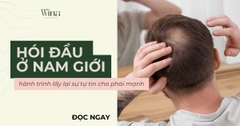 Hói Đầu Có Đáng Sợ: Hành Trình Lấy Lại Sự Tự Tin Cho Phái Mạnh