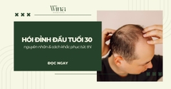 Hói Đỉnh Đầu Tuổi 30: Nguyên Nhân & Cách Khắc Phục Tức Thì