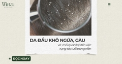 Da Đầu Khô Ngứa Và Gàu Kéo Dài: Mối Liên Hệ Với Tình Trạng Rụng Tóc Trung Niên