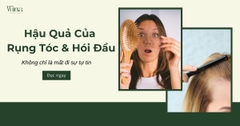 Hậu Quả Của Việc Rụng Tóc, Hói Đầu: Không Chỉ Là Mất Đi Sự Tự Tin