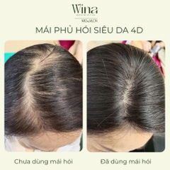 Tóc Giả Nữ Giá Bao Nhiêu Là Hợp Lý? So Sánh Chi Tiết Nhất