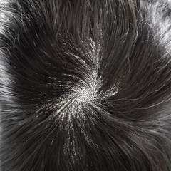 Tóc Giả Nam Che Hói - Kiểu Quiff Bằng Tóc Thật | Wina