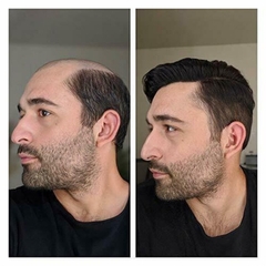 Tóc Giả Nam Che Hói - Kiểu Quiff Bằng Tóc Thật | Wina
