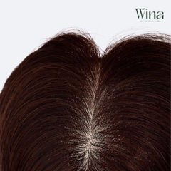 Tóc Giả Che Hói Đỉnh Đầu Nữ - Mái Thưa Xoăn Lọn Siêu Da 4D Dài 35cm | Wina