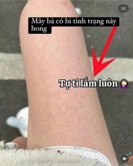 Gel tắm gội A-derma Moissant trị chàm bé 2y, trị mụn lưng cho người lớn 750ml- Pháp