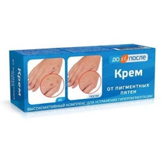 sale Kem tay KPEM trị đồi mồi, vết nám, sạm, đốm nâu da tay 50g