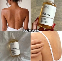 Toner tẩy da chết hóa học The Ordinary Glycolic Acid 7% Exfoliating Toner