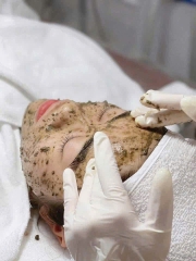 Peel làm sạch sâu bằng thảo dược Christina BioPhyto 4A Herbal Peel- Hàn Quốc