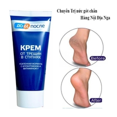 SALE date t7/24 Kem chống nứt nẻ gót chân Kpem TEMA 50ml - Nga