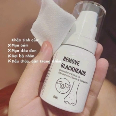 Ủ mụn đầu đen Remove Blackheads làm sạch sợi bã nhờn 50ml - Mỹ