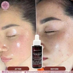 SERUM KẼM EKSEPTION ZNPCA KIỀM DẦU, MỤN, CẤP NƯỚC, LÀNH DA NHANH