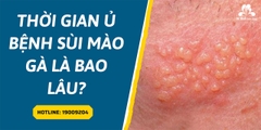 Dấu hiệu và thời gian ủ bệnh sùi mào gà là bao lâu? Cần lưu ý điều gì