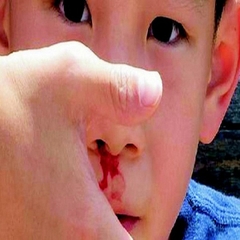 Phòng khám 41 Đặng Văn Ngữ-điều trị dứt điểm chảy máu mũi