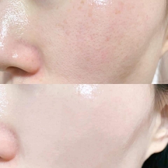 Serum dưỡng da Vitamin B5 + HA GC Nature Dual Hyaluronic Acid Essence 100ml, Dưỡng da căng bóng rạng ngời