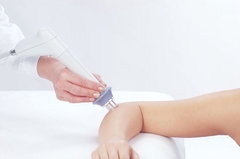 MÁY ĐIỀU TRỊ SÓNG XUNG KÍCH BTL-6000 SWT EASY