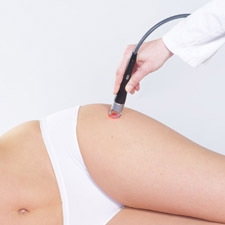 Laser cường độ cao 30W