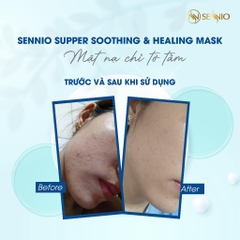 Bộ sản phẩm dưỡng da cấp ẩm toàn diện Sennio - Combo da xinh rạng rỡ nước hoa hồng mặt nạ dưỡng da Dr.Lavic