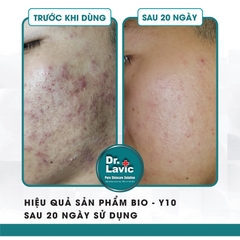 Serum Trị Mụn Chống Lão Hóa Công Nghệ USA DR.LAVIC BIO-Y10 Retinol Peptide Complex 15ML DR924