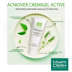 Kem dưỡng MartiDerm Acniover Cremigel Active 40ml (ktđ)