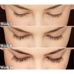 Huyết Thanh Dưỡng Dài Mi Eveline 8 In 1 Total Action Concentrated Eyelash Serum 10ml