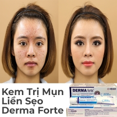 Gel trị mụn và giảm thâm sẹo Derma Forte Alcom 15g