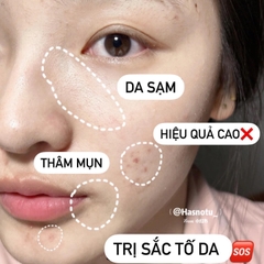 Kem dưỡng Fixderma Skarfix – TX Cream 15g (ktđ)