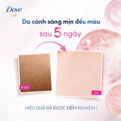 Kem Dưỡng Sáng Khử Mùi Sáng Mịn Cao Cấp Dove Deodorant Dry Serum 40ml