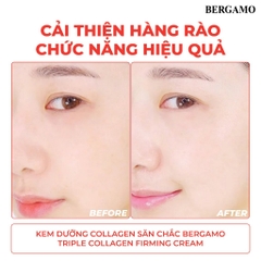 Kem Dưỡng Collagen Săn Chắc Bergamo Triple Collagen Firming Cream 50g
