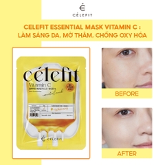 Mặt Nạ Cấp Ẩm, Dưỡng Da Celefit Essential Mask 23g