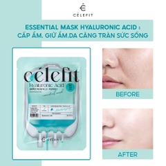 Mặt Nạ Cấp Ẩm, Dưỡng Da Celefit Essential Mask 23g