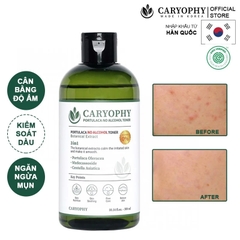 Nước Hoa Hồng Chăm Sóc Da Dầu Mụn Caryophy Portulaca Toner 300ml