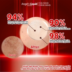 Kem Dưỡng Mờ Nám Chuyên Sâu Angel's Liquid Tranexamic Mela Cream 50ml
