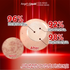 Siêu Tinh Chất Xoá Thâm Đỏ, Mờ Sạm Nám Angel's Liquid Tranexamic Mela Ampoule 30ml
