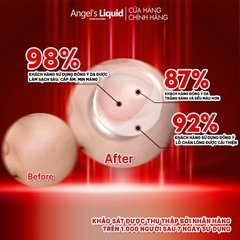 Nước Thần Làm Trắng Da, Dưỡng Da Toàn Diện Angel's Liquid Tone Up Whitening Program Treatment Essence 150ml