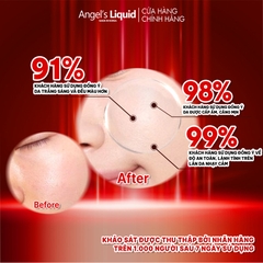 Tinh Chất Angel's Liquid Dưỡng Sáng Da, Mờ Thâm 7 Day Whitening Program Glutathione 700 V Ampoule 30ml