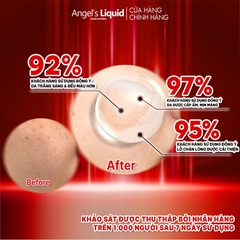 Tinh Chất Truyền Trắng Trị Nám Chuyên Sâu Angel's Liquid Glutathione + Niacinamide 700 V-Ampoule 30ml
