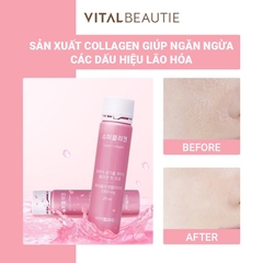 Nước Uống Bổ Sung Collagen Hỗ Trợ Làm Đẹp Và Ngăn Ngừa Lão Hóa Vital Beautie Super Collagen 25ml*30 ống