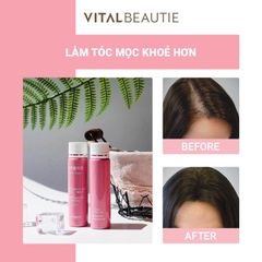 Nước Uống Bổ Sung Collagen Hỗ Trợ Làm Đẹp Và Ngăn Ngừa Lão Hóa Vital Beautie Super Collagen 25ml*30 ống