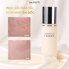 Nước Hoa Hồng Rau Má Làm Dịu, Dưỡng Sáng Da Dr.Pepti+ Centella Toner 180ml