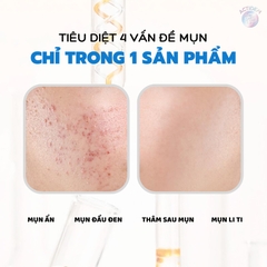 Kem Trị Mụn, Thâm Actidem Derma Gel 18g