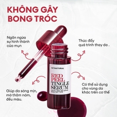 (Size nhỏ) Tinh Chất Tẩy Da Chết Hóa Học So’Natural Red Peel Tingle Serum 11ml